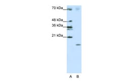 Aviva Systems Biology Corp SRP19 Antibody - middle region (ARP40456_T100)