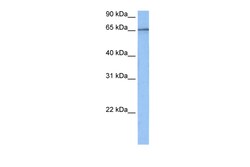 Aviva Systems Biology Corp TAF15 Antibody - N-terminal region (ARP40467_P050)