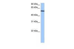 Aviva Systems Biology Corp YARS Antibody - N-terminal region (ARP40472_P050)