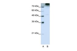 Aviva Systems Biology Corp EIF3S9 Antibody - C-terminal region (ARP40483_P050)