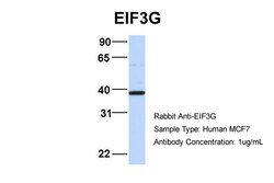 Aviva Systems Biology Corp EIF3G Antibody - middle region (ARP40485_P050)
