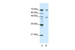 Aviva Systems Biology Corp PABPC4 Antibody - N-terminal region (ARP40496_T100)