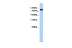 Aviva Systems Biology Corp SYNJ1 Antibody - N-terminal region (ARP40498_P050)
