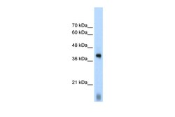 Aviva Systems Biology Corp EIF2S1 Antibody - C-terminal region (ARP40508_T100)