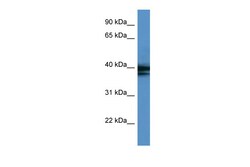 Aviva Systems Biology Corp HNRPAB Antibody - C-terminal region (ARP40514_P050)