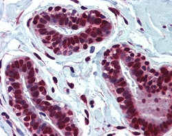 Aviva Systems Biology Corp HNRNPC Antibody - middle region (ARP40517_P050)