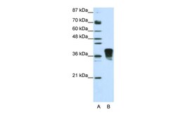 Aviva Systems Biology Corp SFRS10 Antibody - N-terminal region (ARP40528_T100)