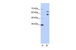 Aviva Systems Biology Corp TROVE2 Antibody - N-terminal region (ARP40535_P050)