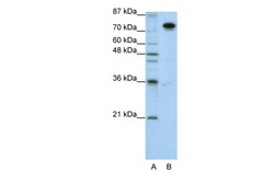 Aviva Systems Biology Corp SFPQ Antibody - N-terminal region (ARP40572_T100)