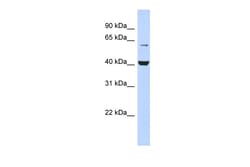Aviva Systems Biology Corp PIGK Antibody - N-terminal region (ARP40588_P050)