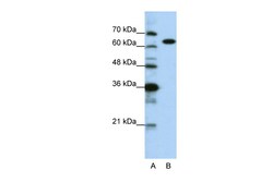 Aviva Systems Biology Corp KARS Antibody - C-terminal region (ARP40589_P050)