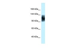 Aviva Systems Biology Corp Srrm1 Antibody - C-terminal region (ARP40607_P050)