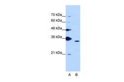 Aviva Systems Biology Corp PPIE Antibody - middle region (ARP40627_T100)