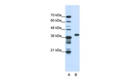 Aviva Systems Biology Corp PCBP1 Antibody - middle region (ARP40630_T100)