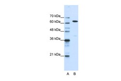 Aviva Systems Biology Corp NXF1 Antibody - N-terminal region (ARP40639_T100)