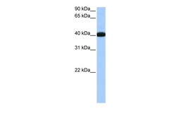 Aviva Systems Biology Corp NOL5A Antibody - middle region (ARP40645_P050)