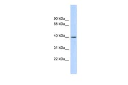 Aviva Systems Biology Corp RAD51AP1 Antibody - middle region (ARP40653_P050)