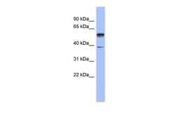 Aviva Systems Biology Corp KHDRBS3 Antibody - N-terminal region (ARP40664_P050)