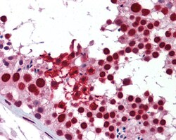Aviva Systems Biology Corp KHDRBS1 Antibody - middle region (ARP40666_P050)