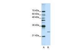Aviva Systems Biology Corp POP4 Antibody - C-terminal region (ARP40674_T100)
