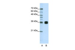 Aviva Systems Biology Corp HNRPA0 Antibody - middle region (ARP40686_T100)