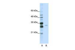 Aviva Systems Biology Corp SFRS1 Antibody - C-terminal region (ARP40691_P050)