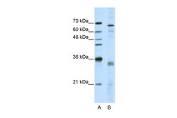 Aviva Systems Biology Corp SFRS1 Antibody - middle region (ARP40692_T100)