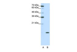 Aviva Systems Biology Corp SNRPD1 Antibody - N-terminal region (ARP40693_P050)