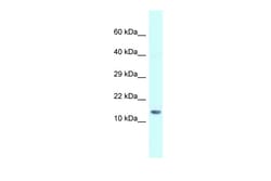 Aviva Systems Biology Corp Gm14277 Antibody - N-terminal region (ARP40694_P050)