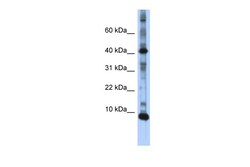 Aviva Systems Biology Corp LSM6 Antibody - N-terminal region (ARP40707_P050)