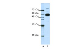 Aviva Systems Biology Corp NONO Antibody - C-terminal region (ARP40716_T100)