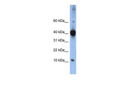 Aviva Systems Biology Corp LSM4 Antibody - middle region (ARP40728_P050)