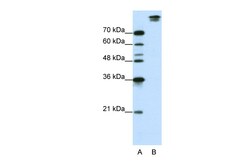 Aviva Systems Biology Corp SF3B1 Antibody - N-terminal region (ARP40733_T100)