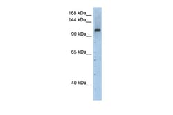 Aviva Systems Biology Corp PRPF6 Antibody - N-terminal region (ARP40735_T100)