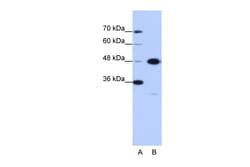 Aviva Systems Biology Corp GTPBP9 Antibody - N-terminal region (ARP40744_P050)
