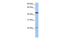 Aviva Systems Biology Corp EWSR1 Antibody - N-terminal region (ARP40750_P050)