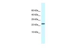 Aviva Systems Biology Corp Csdc2 Antibody - middle region (ARP40767_P050)
