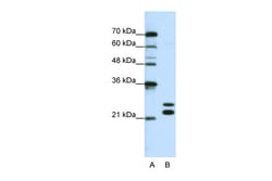 Aviva Systems Biology Corp CSDC2 Antibody - N-terminal region (ARP40768_T100)