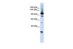 Aviva Systems Biology Corp DIS3 Antibody - N-terminal region (ARP40793_P050)