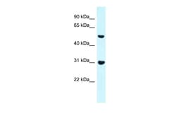 Aviva Systems Biology Corp Fnbp1 Antibody - N-terminal region (ARP40800_P050)