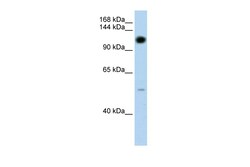 Aviva Systems Biology Corp PUM2 Antibody - N-terminal region (ARP40810_T100)