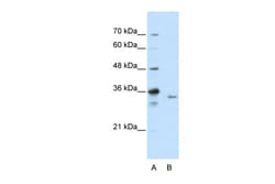 Aviva Systems Biology Corp EXOSC3 Antibody - C-terminal region (ARP40824_T100)