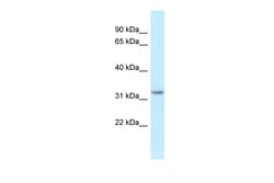 Aviva Systems Biology Corp Hsd17b11 Antibody - middle region (ARP40842_P050)