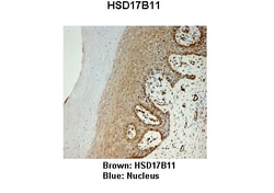 Aviva Systems Biology Corp HSD17B11 Antibody - N-terminal region (ARP40843_P050)