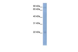 Aviva Systems Biology Corp OAS2 Antibody - middle region (ARP40852_P050)