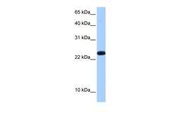 Aviva Systems Biology Corp C19orf24 Antibody - N-terminal region (ARP40883_P050)