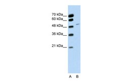 Aviva Systems Biology Corp RBM22 Antibody - C-terminal region (ARP40889_P050)