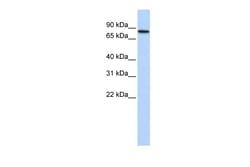 Aviva Systems Biology Corp ADARB2 Antibody - middle region (ARP40918_P050)