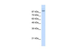 Aviva Systems Biology Corp MATR3 Antibody - N-terminal region (ARP40922_T100)