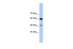 Aviva Systems Biology Corp DAZAP1 Antibody - C-terminal region (ARP40924_T100)